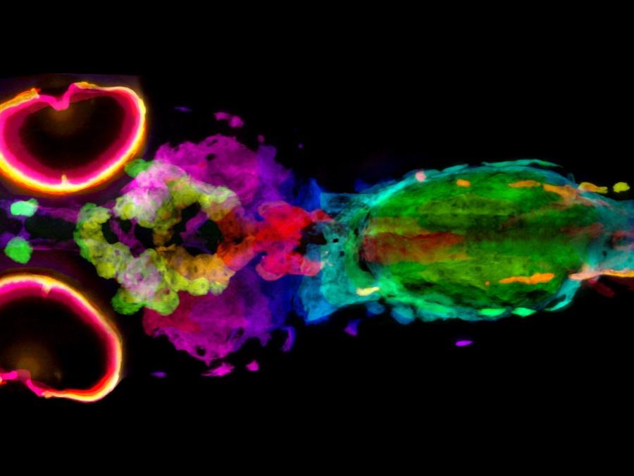 Melanin is visualized in a silver-stained, 5-day-old zebrafish